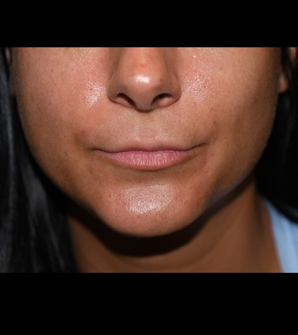 Definition, before