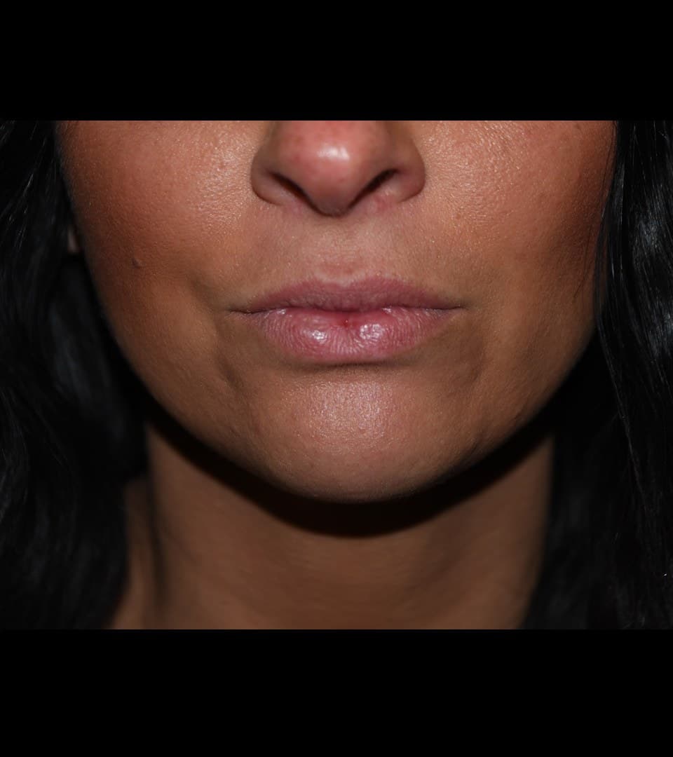 Border and definition, before