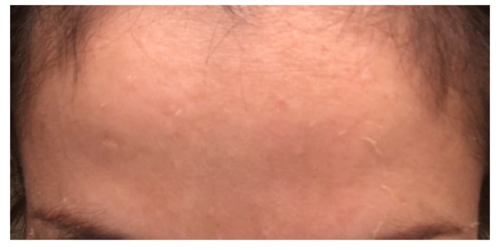 Tone and texture, after