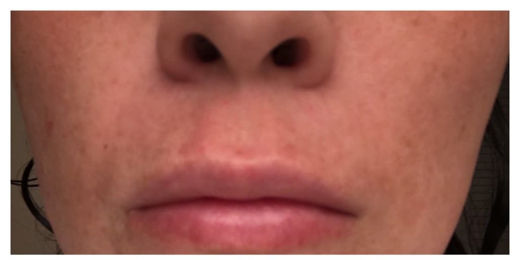 Around the mouth, before