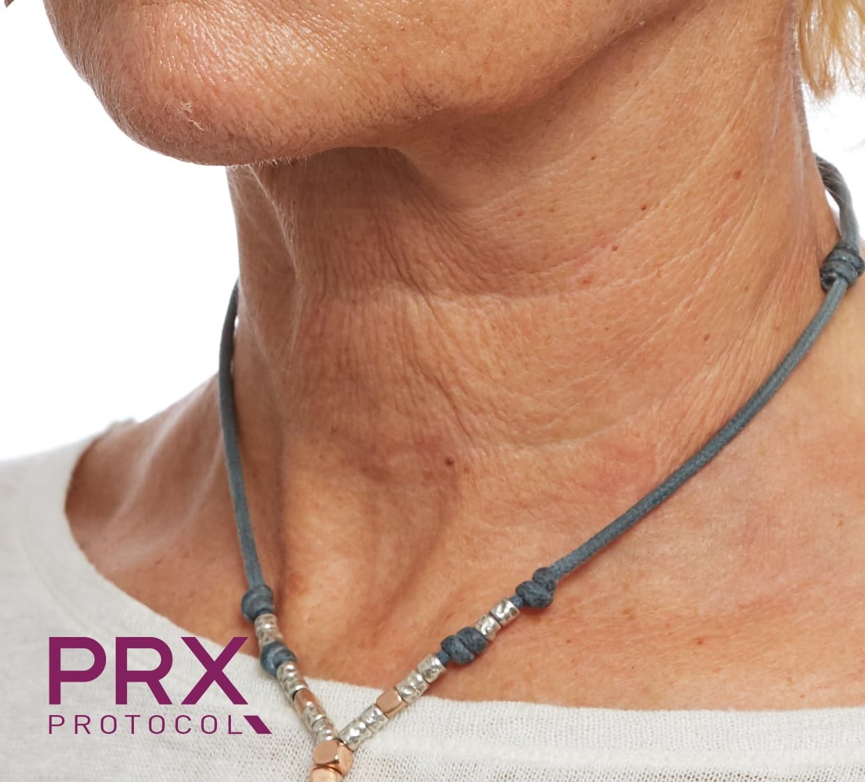 Neck, after
