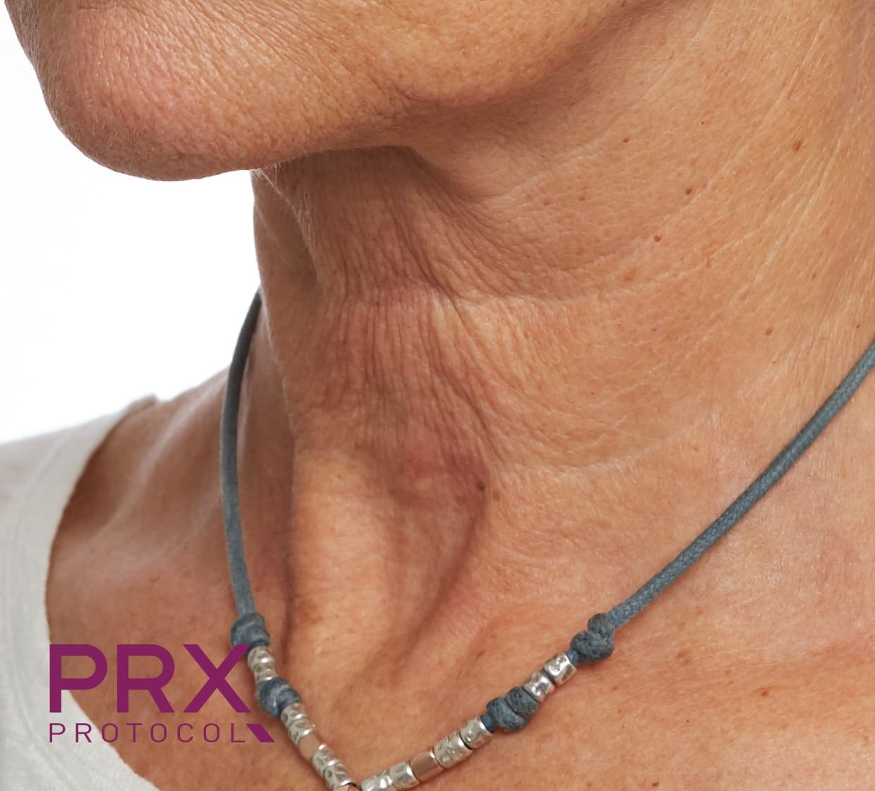 Neck, before