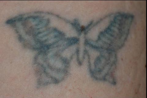 Blue linework, before
