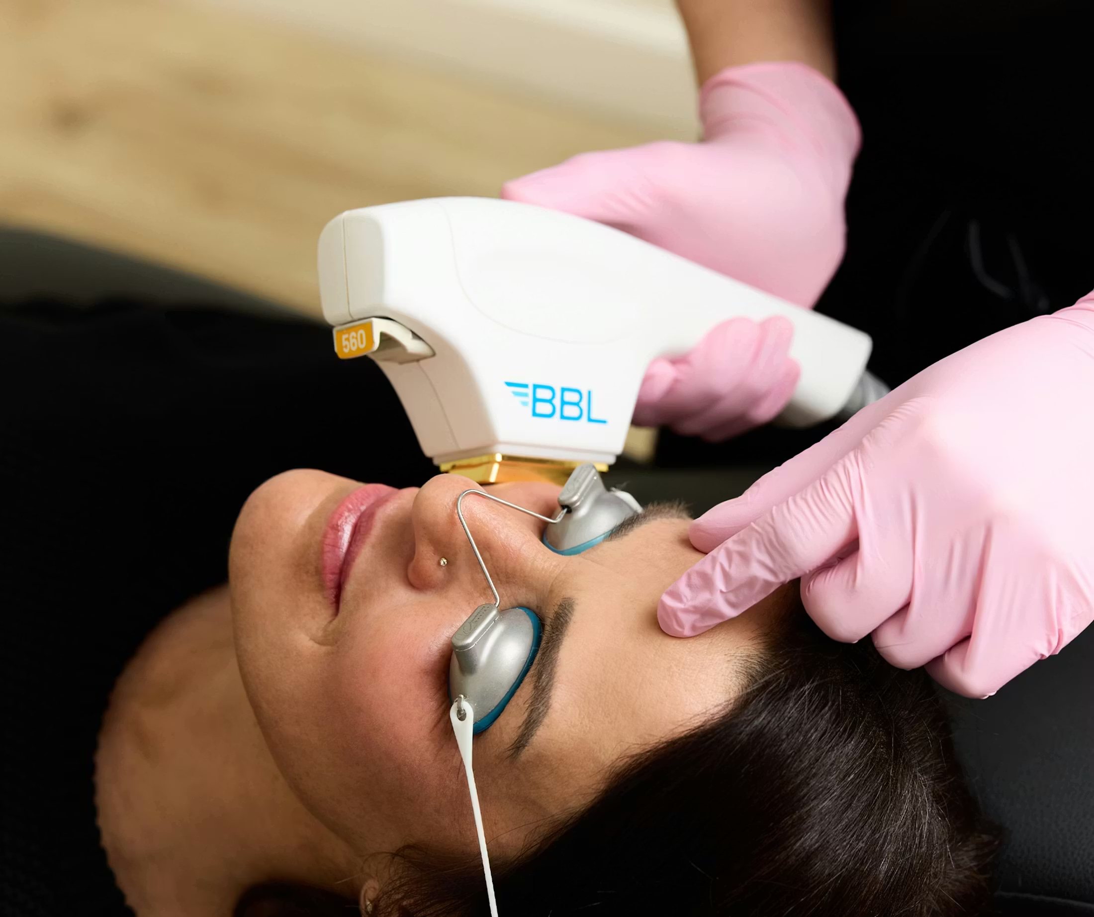 A BBL Hero handpiece over a patient's cheek, eye shields in place