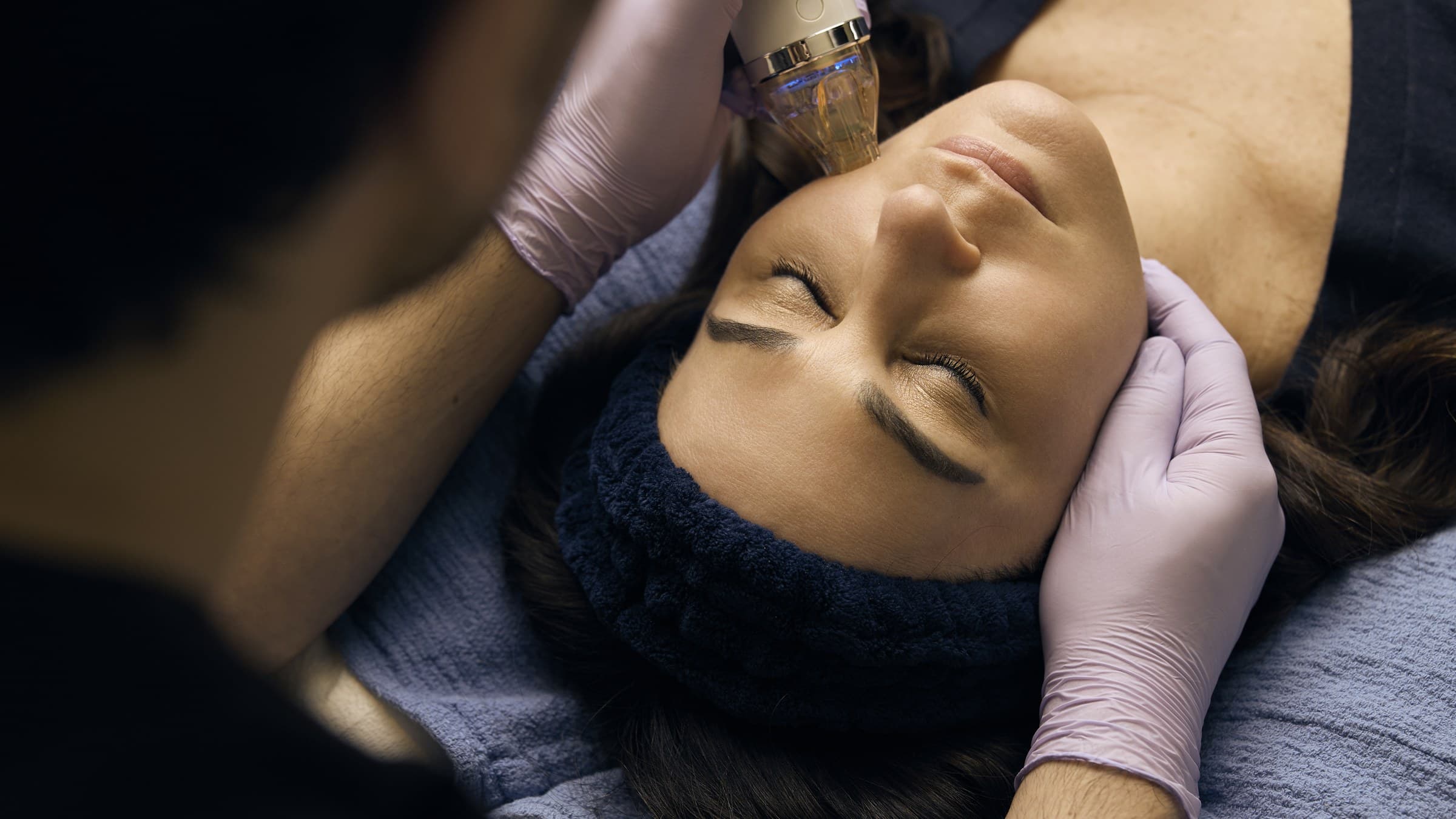 An Acqua Blu provider guiding the RF microneedling handpiece across a patient's forehead