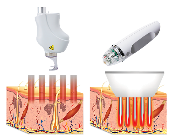 Facial Rejuvenation in Pittsburgh