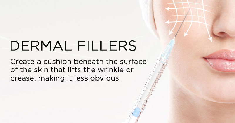 dermal-fillers