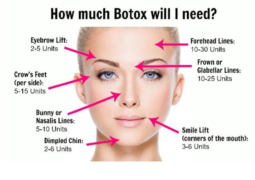 how much botox will i need-page-001