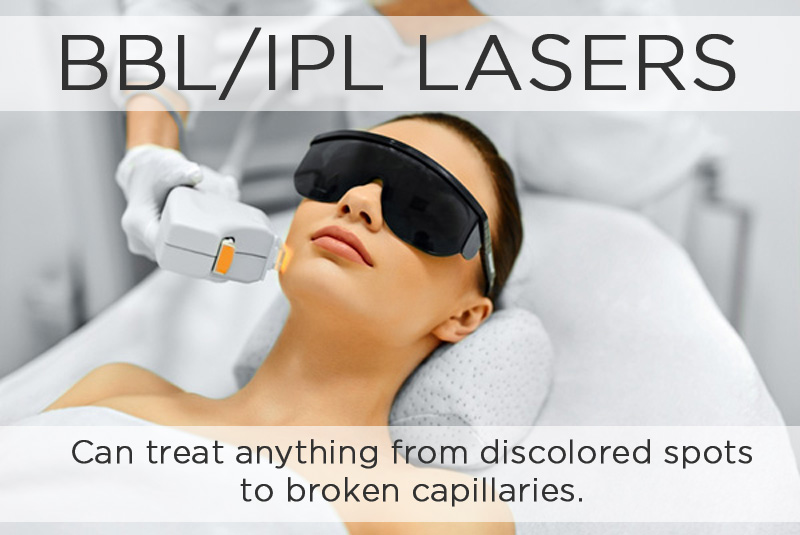 Best Procedures For 30's Broadband Light/intense Pulsed Light